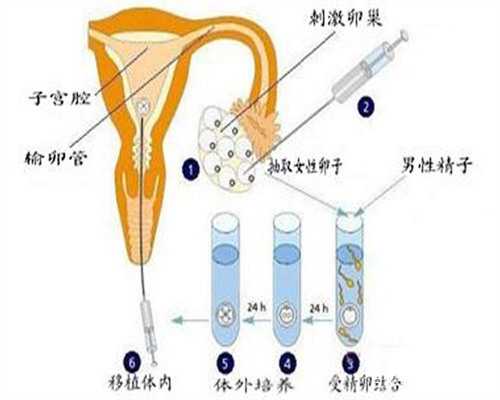 2026广东省试管医院排名前十信息！广东省做试管医院排名！