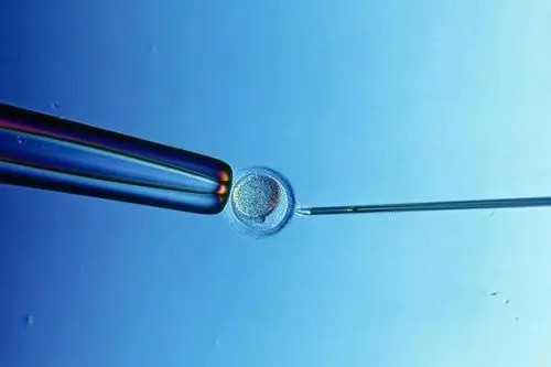 高龄绝经供卵试管婴儿&365助孕,盘点怀孕前备孕补充叶酸的6个注意事项-记得收