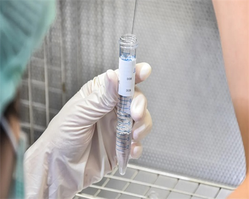 供卵试管一般在哪里做&借卵多少钱,女性经期孕期穿内裤有啥要求？两大要点别