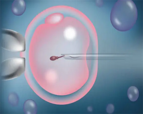 广州供卵代生中心,广州助孕公司-广州三代试管医院