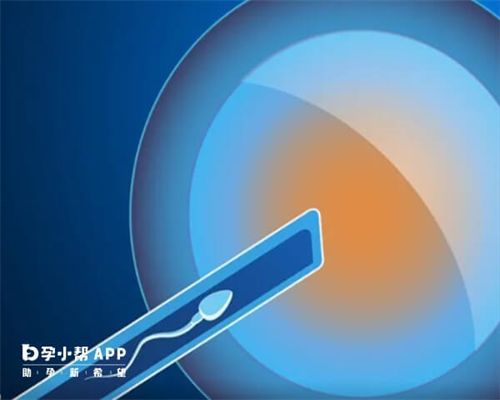 广州本地助孕机构,广州三代试管民营医院_广州助孕机构排行榜