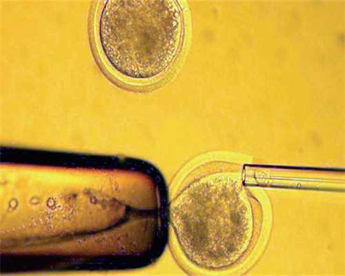 广东做试管医生推荐的医院排名哪家最好？广东做试管最专业的医院？