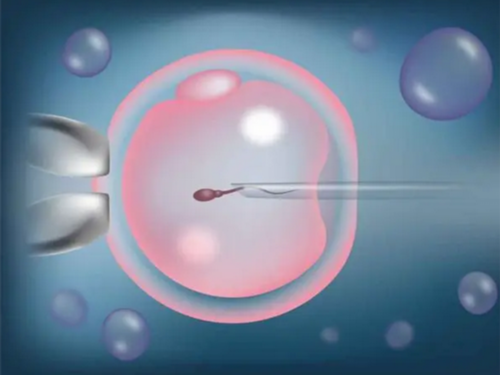 55岁高龄试管成功案例&中国供卵机构,男性不孕不育的原因和治疗方法