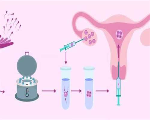 孕早期头痛：误区、饮食关系与调理经验分享_孕期头痛：误区、影响与解决办