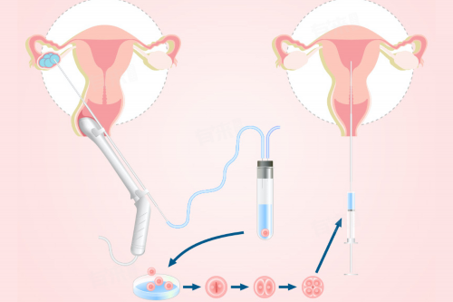 广州代孕套餐多少钱,试管龙凤胎宝宝之第一次住院-最好的胚胎跟碎片一起移植