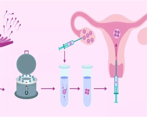 广州哪里做代孕最好,【北京供卵的医院、泰国供卵医院、广州供卵试管成功率