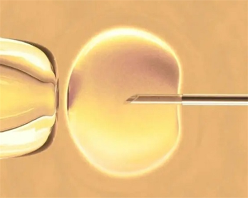 广州代孕公司包成功,广州供卵靠谱,广州供卵靠不靠谱