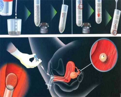 广州3代试管医院排名(广州三代试管成功率高)