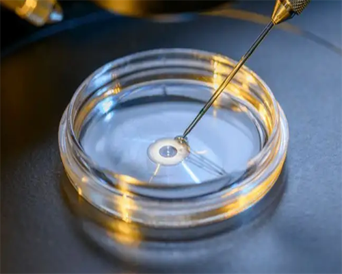 3代试管只做无创可以吗&去那找代孕妈妈,孕期检查时间延后几天有影响吗