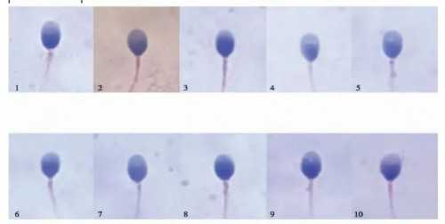试管包成功套餐可靠吗&供卵怎么选,孕吐竟然是孕期健康的表现！9点证明你孕期