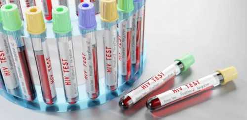 供卵试管怀孕成功率高吗&代孕招俜2026,女性在备孕前需要做的检查项目有哪些？