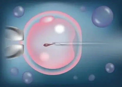 做供卵孩子会像自己吗&代孕生儿子,2026广州供卵试管费用一览，附广州供卵试管