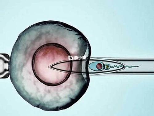 广州试管代孕网,广州试管婴儿黑市，广州外币兑换黑市