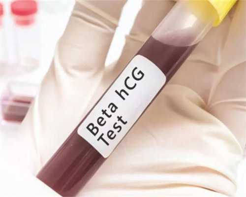 试管婴儿3代选性别&试管弱精成功率高吗,在备孕的时候男性什么菜要少吃？什么