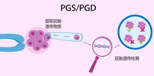 卵巢早衰怀孕真的很难吗&找代孕去那找,备孕提前看！绵阳中心医院试管成功率
