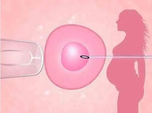 孕期防辐射衣服有效吗？如何正确选择？